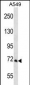 PCCA Antibody (Center)